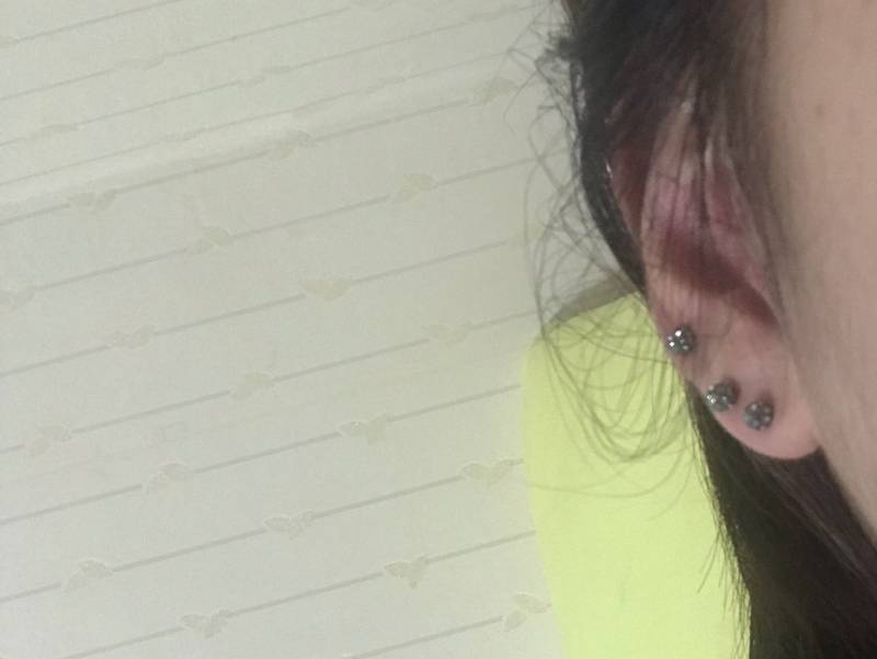 트라거스 막기 전후 | 인스티즈