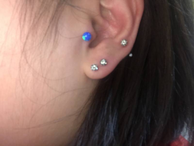 트라거스 막기 전후 | 인스티즈