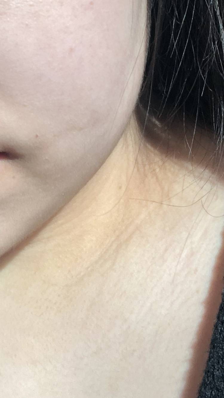 목만 까매 왜이런거야?? | 인스티즈