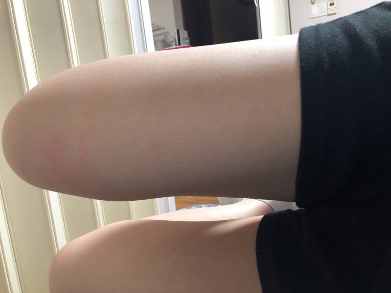 익들아ㅠ나 허벅지 살빠진거봐ㅠ | 인스티즈