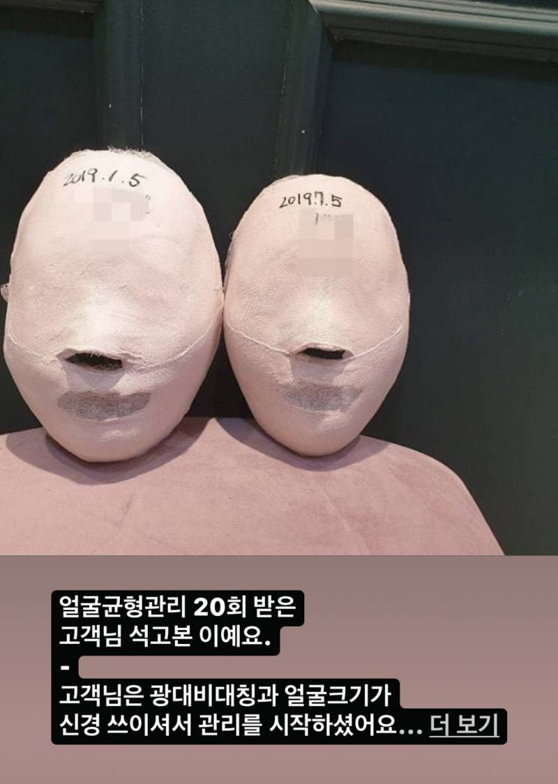아니... 진짜 경락받는다고 이렇게 돼..? - 인스티즈(instiz) 일상 카테고리