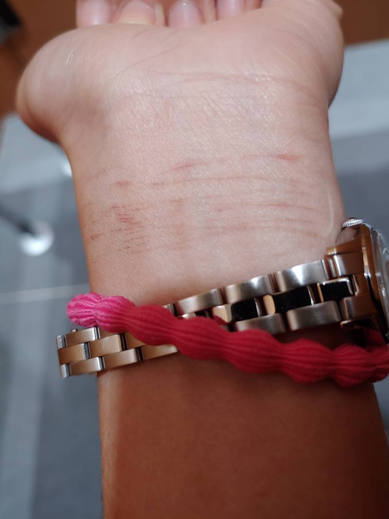 자해한거같아??? | 인스티즈