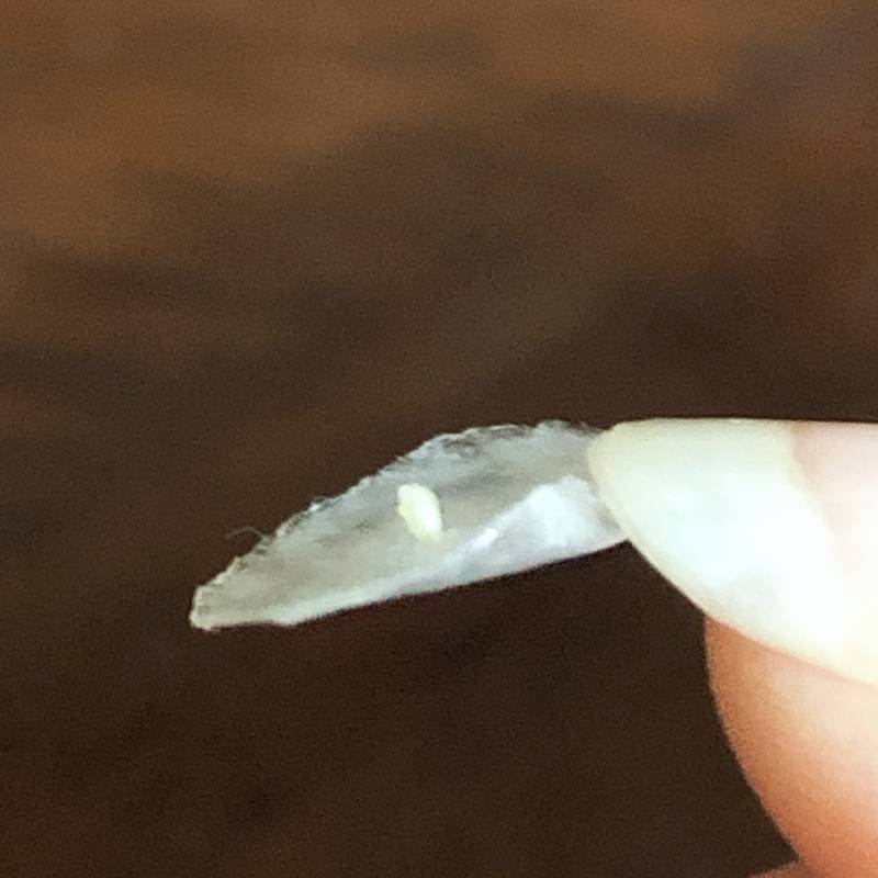 올영 여드름패치 쩐다... 40 (혐주 | 인스티즈