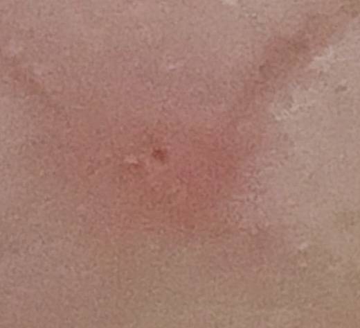 올영 여드름패치 쩐다... 40 (혐주 | 인스티즈