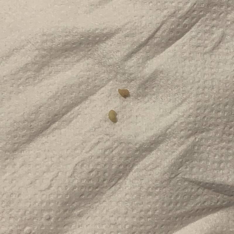 이거 정체가 뭐야? (ㅎㅇㅈㅇ) | 인스티즈