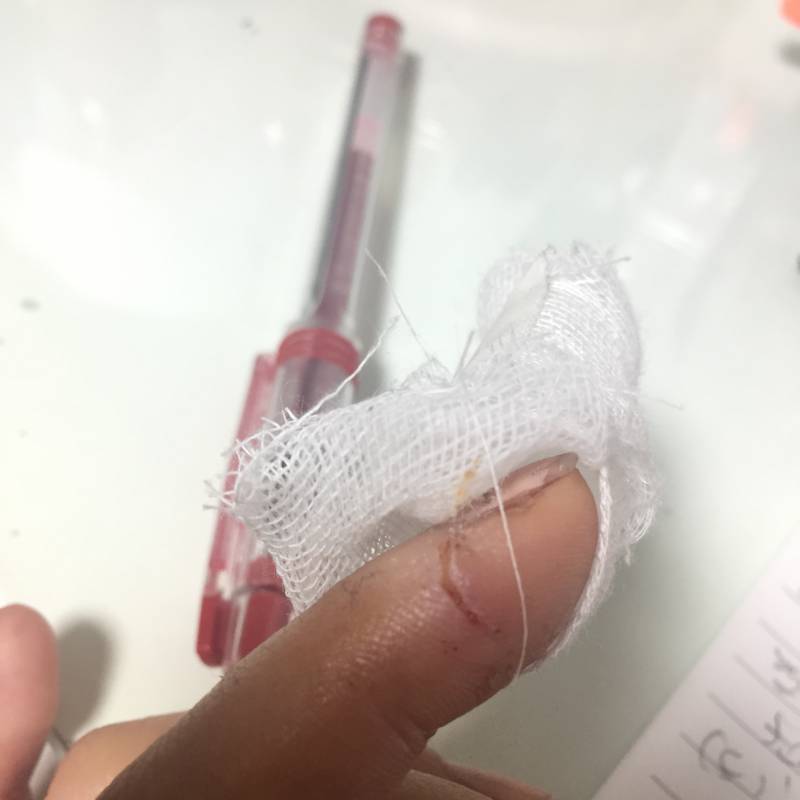 이 상처 심한 거야 ? ㅎㅇㅈㅇ | 인스티즈