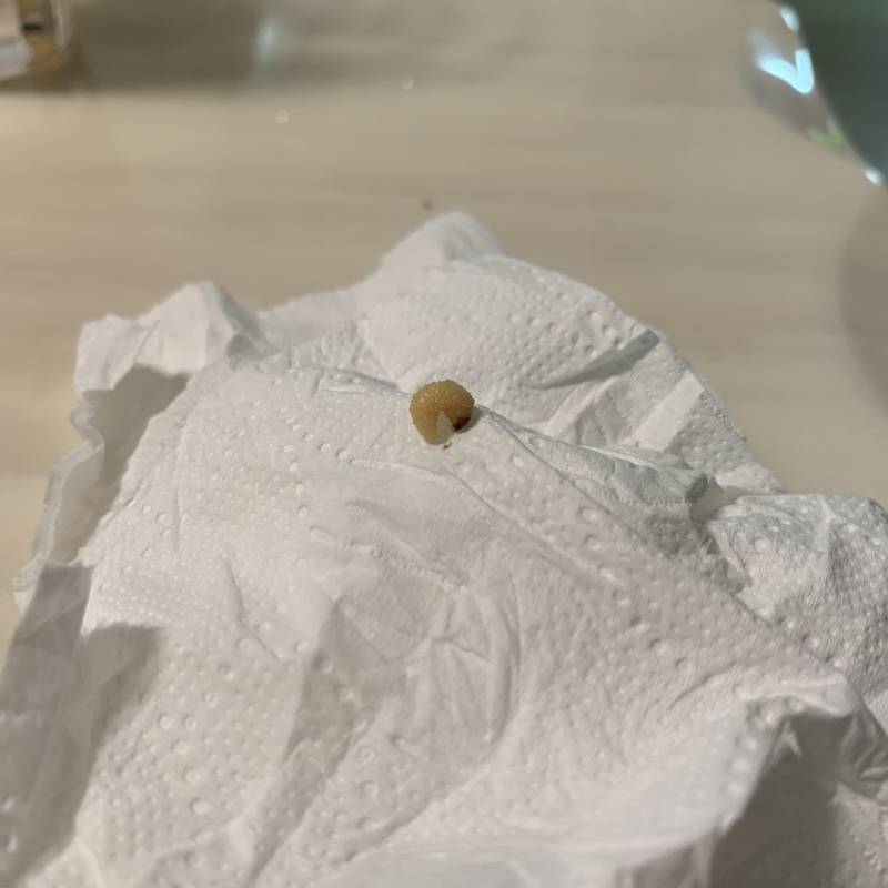 강아지 몸에서 이런 구더기 나올 수 있어? 사진있어ㅠ | 인스티즈