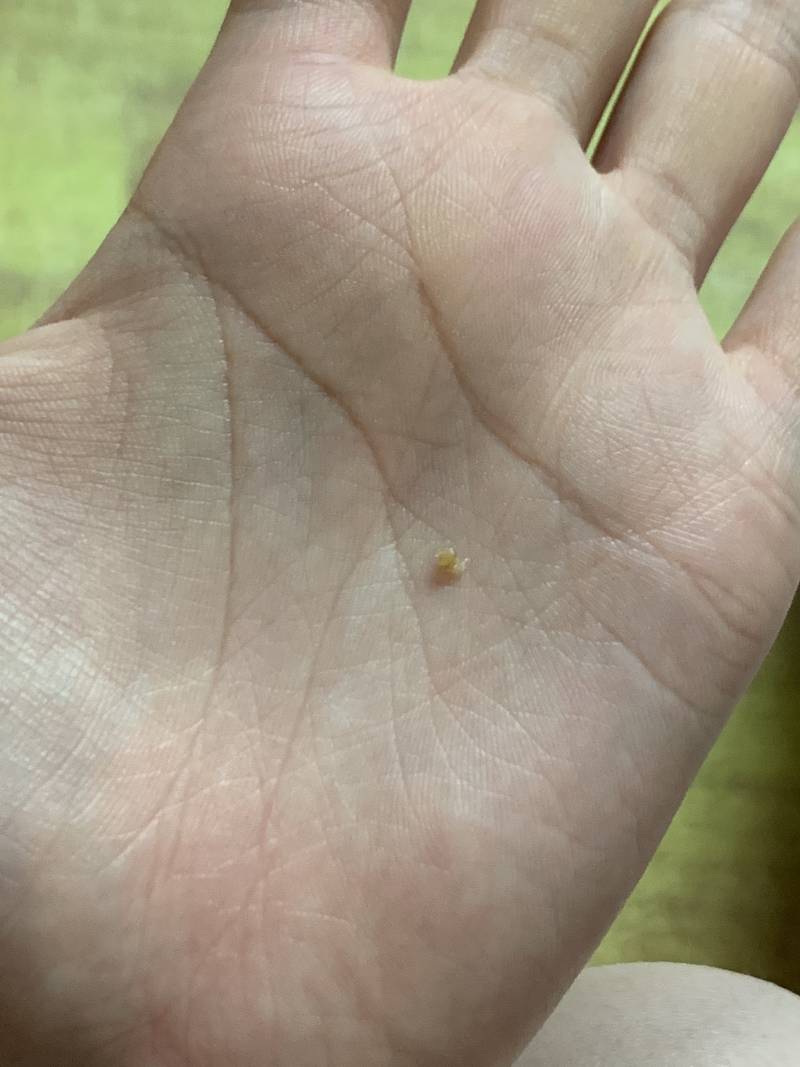 귀에서 왕피지 나옴 40 | 인스티즈