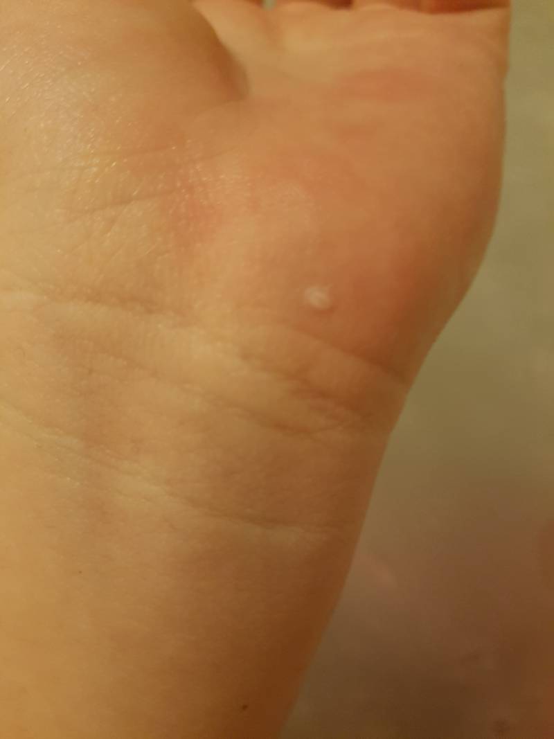 나 손에 이게 뭘까 자꾸 보리가 붙어있어 | 인스티즈