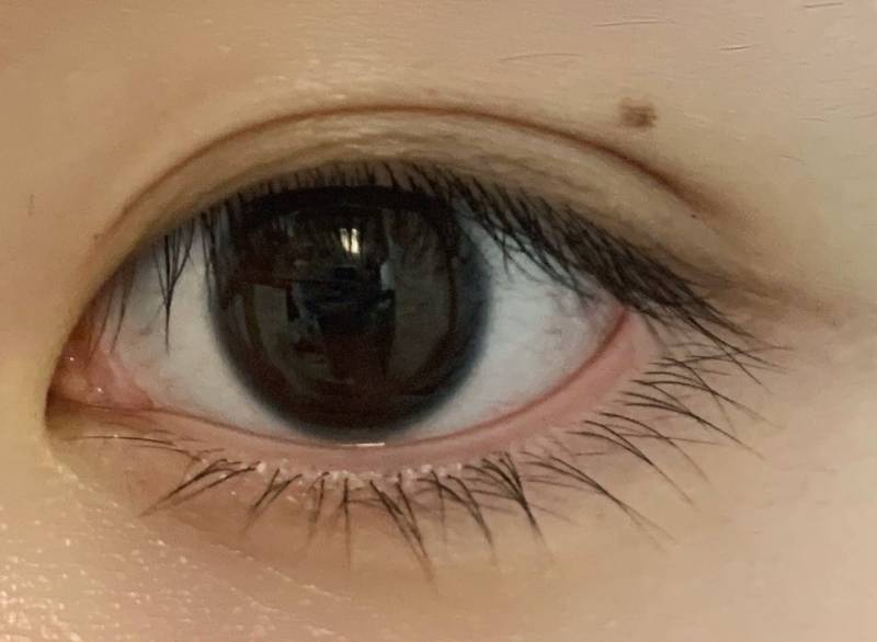 익들이 내 눈이라면 쌍수할 거 같아?? 40 | 인스티즈