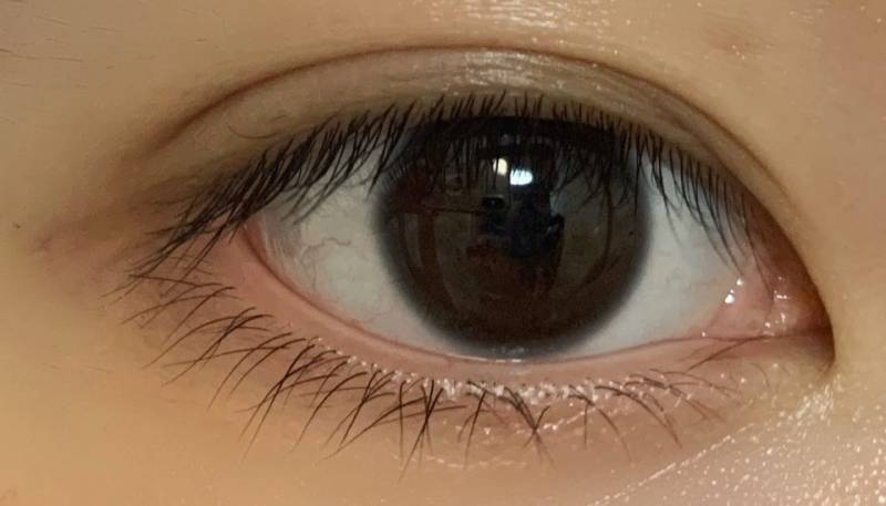 익들이 내 눈이라면 쌍수할 거 같아?? 40 | 인스티즈