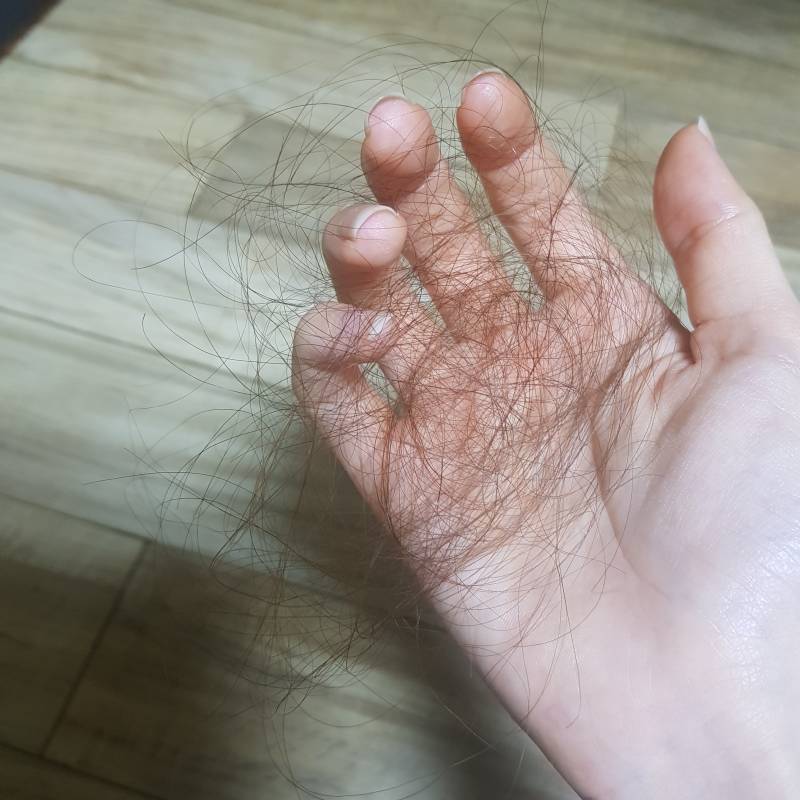 익두라 머리 감을때마다 이만큼씩 빠지는거 탈모각 아니야...?ㅠㅠㅠㅠ | 인스티즈
