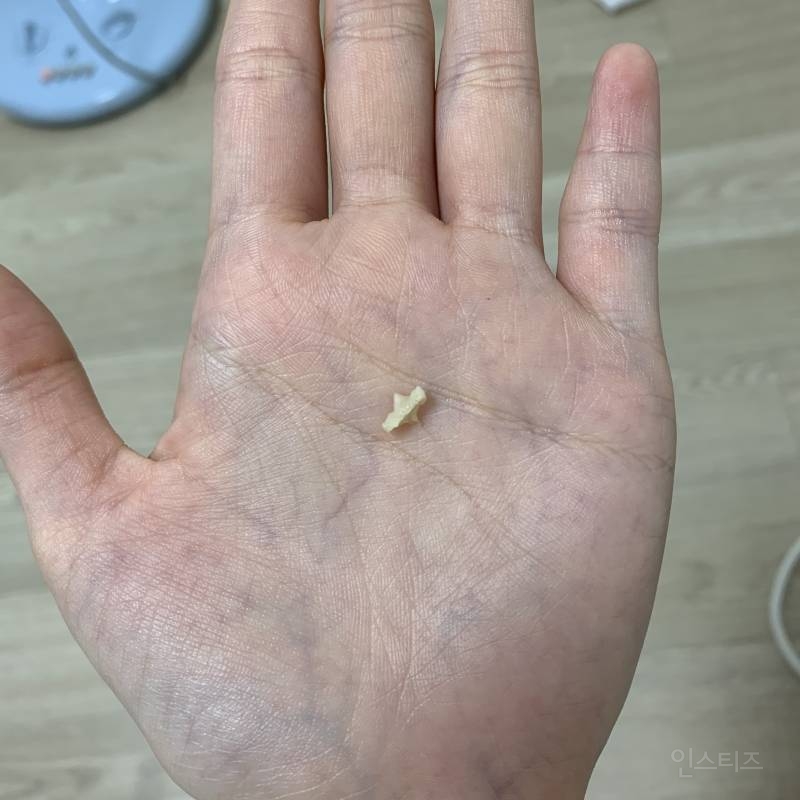 와ㅏㅏ오아ㅏㅏ아ㅏ익드라 울애기 이빨빠젺어 하ㅜㅜㅜㅜㅜㅠㅜㅝㅜㅜ | 인스티즈