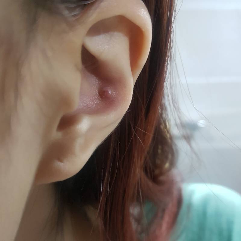 익들아 귀 이거 뭐야???ㅠㅠㅠㅠ 피어싱 뚫은데 이상해ㅜㅠ(ㅎㅇㅈㅇ) | 인스티즈