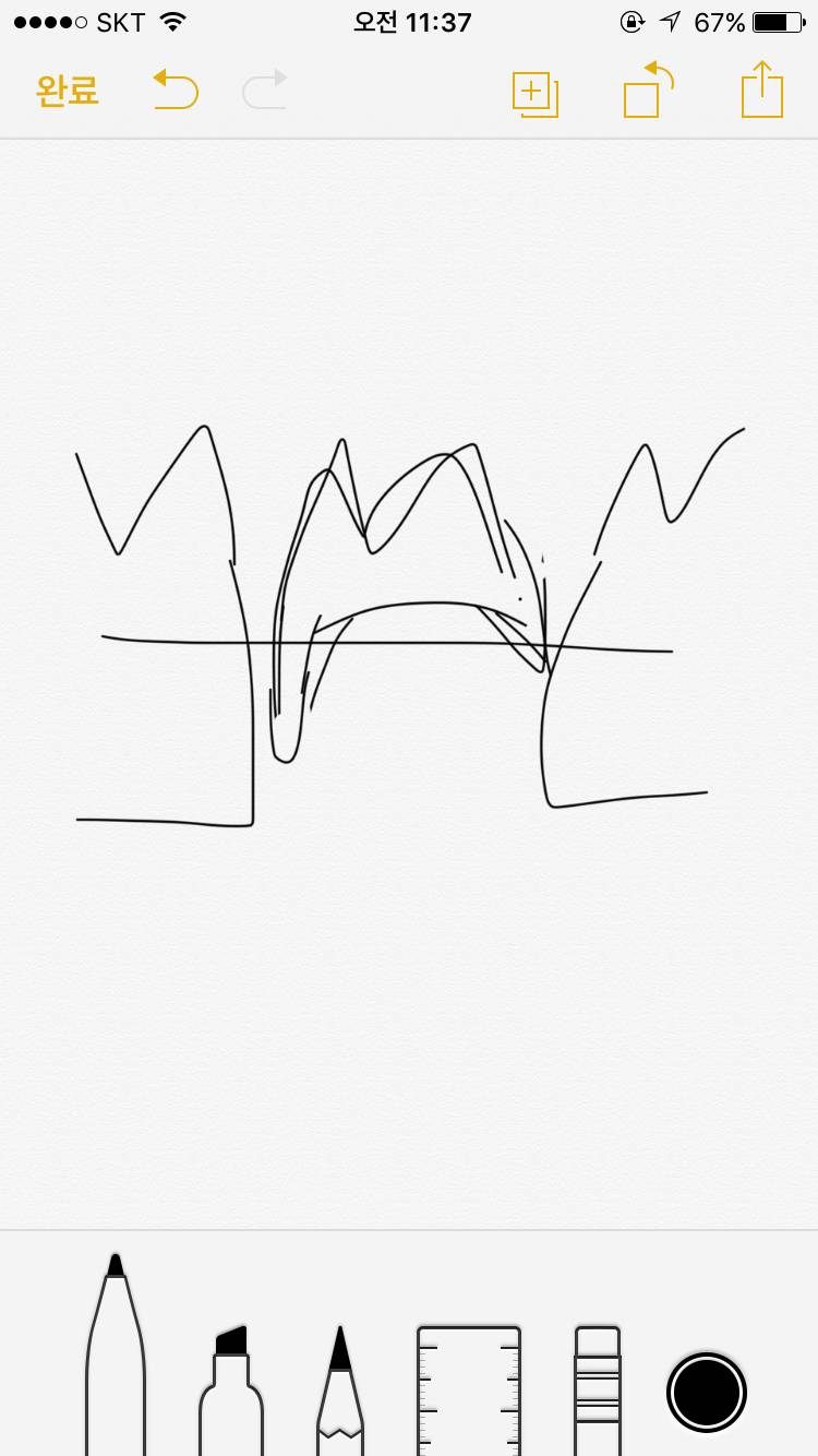 나 이가 이렇게 돼있는데 이거 뽑아야돼? ㅠㅠ | 인스티즈
