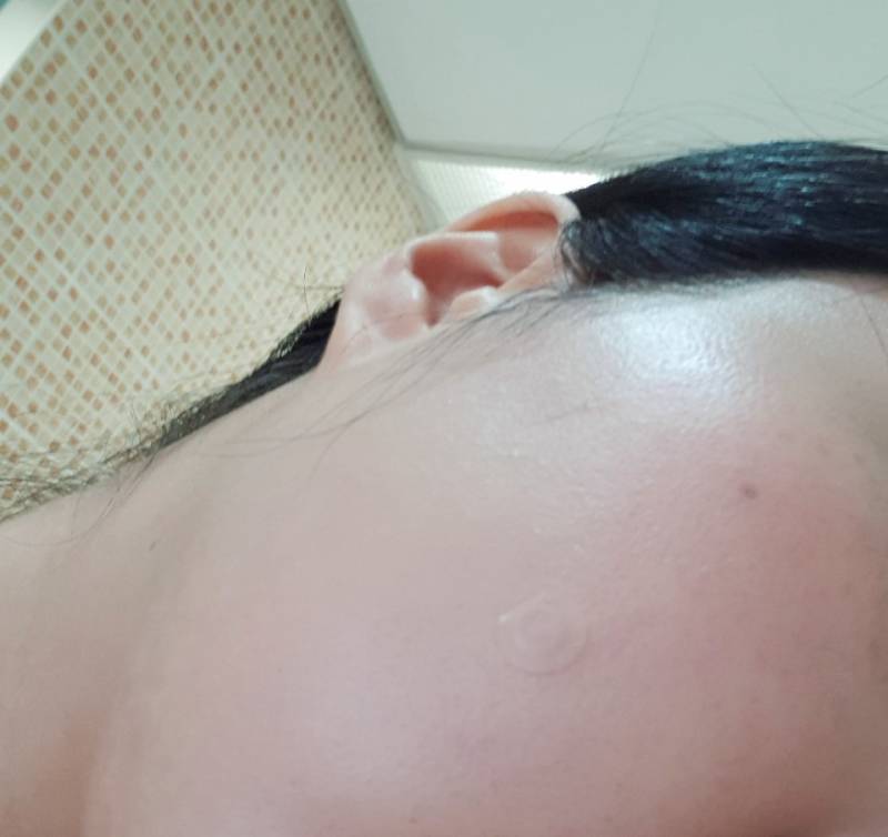 에뛰드 순정스킨로션 쓰고 피부뒤집어졌는데 다나았어 ㅠㅠㅠㅠㅠ40 | 인스티즈