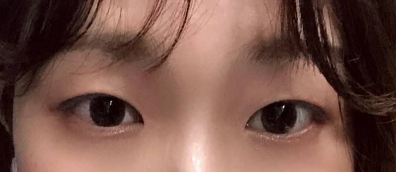 익들아 쌍수 할말 봐쥬라...ㅠㅠㅠㅠ | 인스티즈