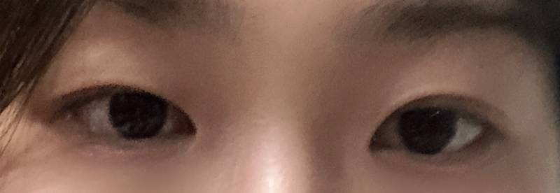 익들아 쌍수 할말 봐쥬라...ㅠㅠㅠㅠ | 인스티즈