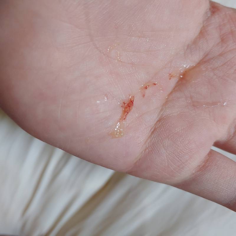 기침을 했는데 이게 나왔어(더러움주의) | 인스티즈