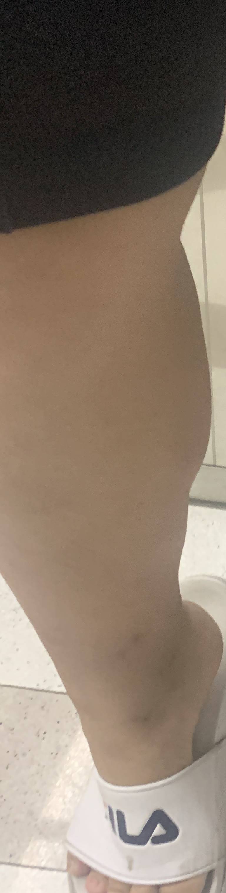 내 다리 이런데 어떻게 빼야할까,,, | 인스티즈