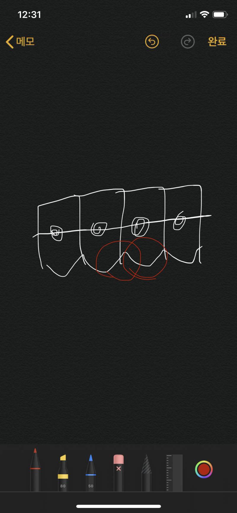 고정식 유지장치 한 익들아 😭😭 | 인스티즈