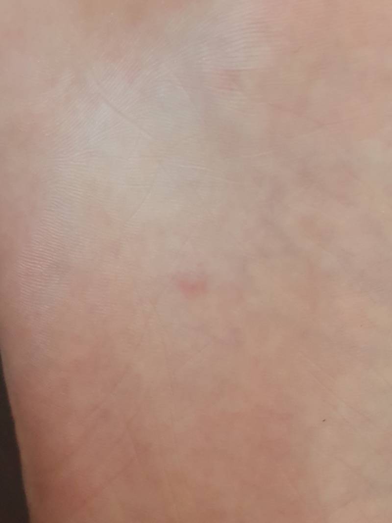 와 모기들아 니네 여기도 무냐 | 인스티즈