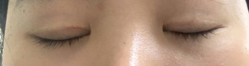 나 이거 쌍커풀 부은 티 많이 나???? | 인스티즈