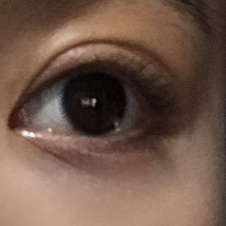 이거 다래끼야? | 인스티즈