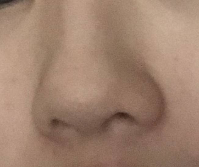 익들이라면 코수술한다 만다 | 인스티즈