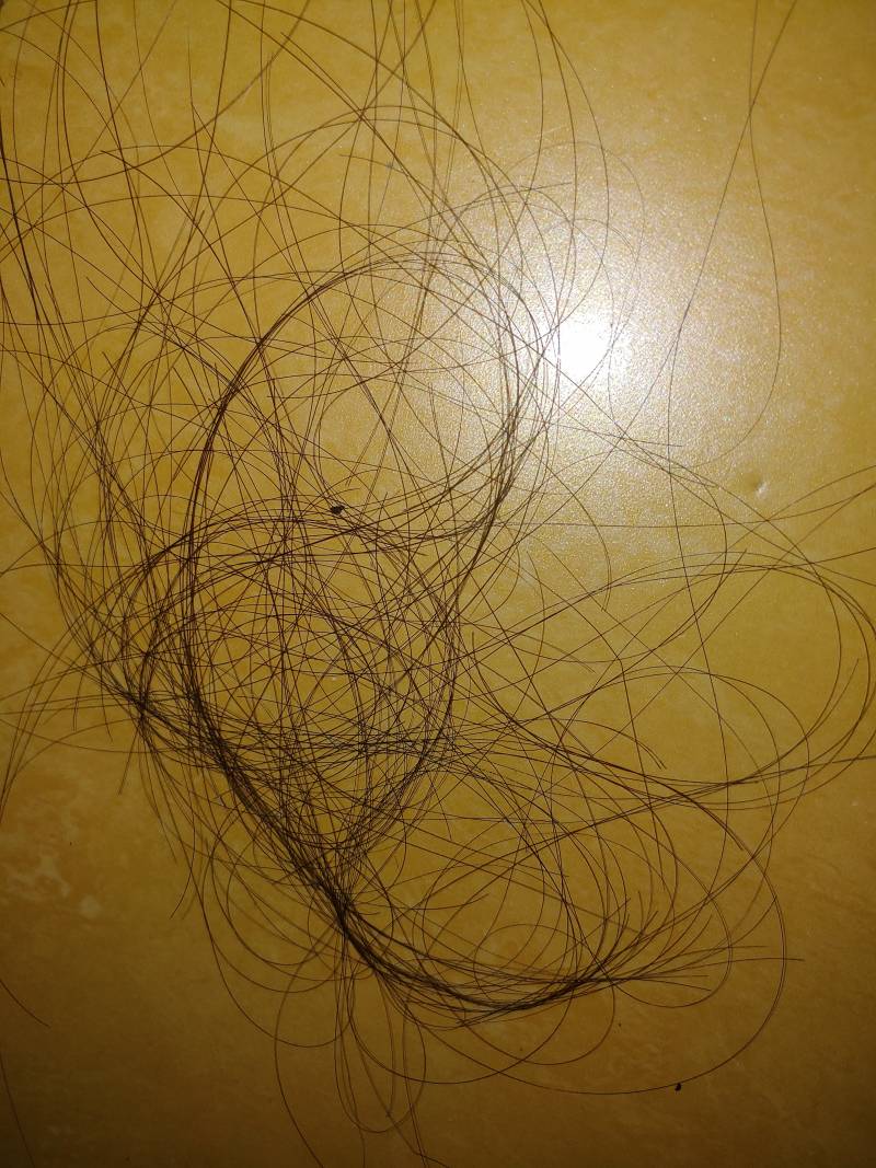 나 이정도면 탈모아녀? | 인스티즈