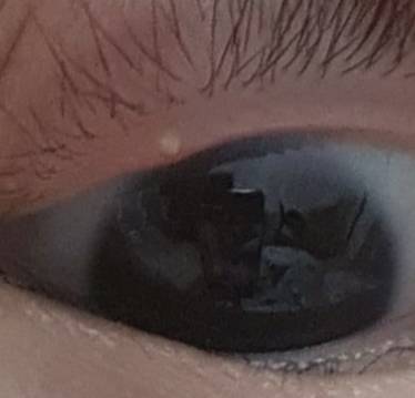 이거 다래끼야??(눈사진주의) | 인스티즈