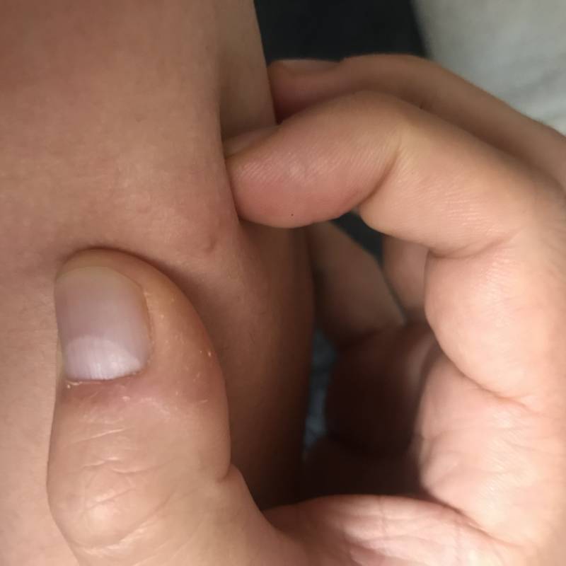 한달전에 IV로 주사맞을때 그때도 맞고나서 혈관튀어나와서 만져지고 엄청아팠는데 4040 하 진짜 | 인스티즈