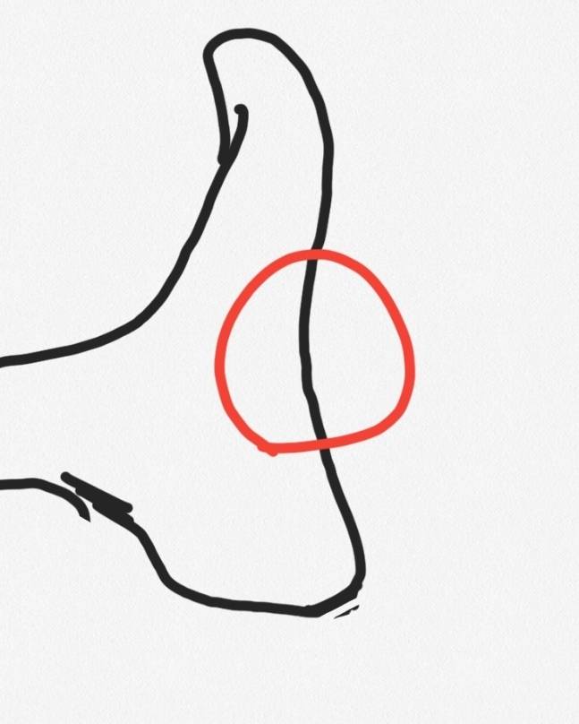 발 여기가 아픈데 파스 붙이면 나아? | 인스티즈