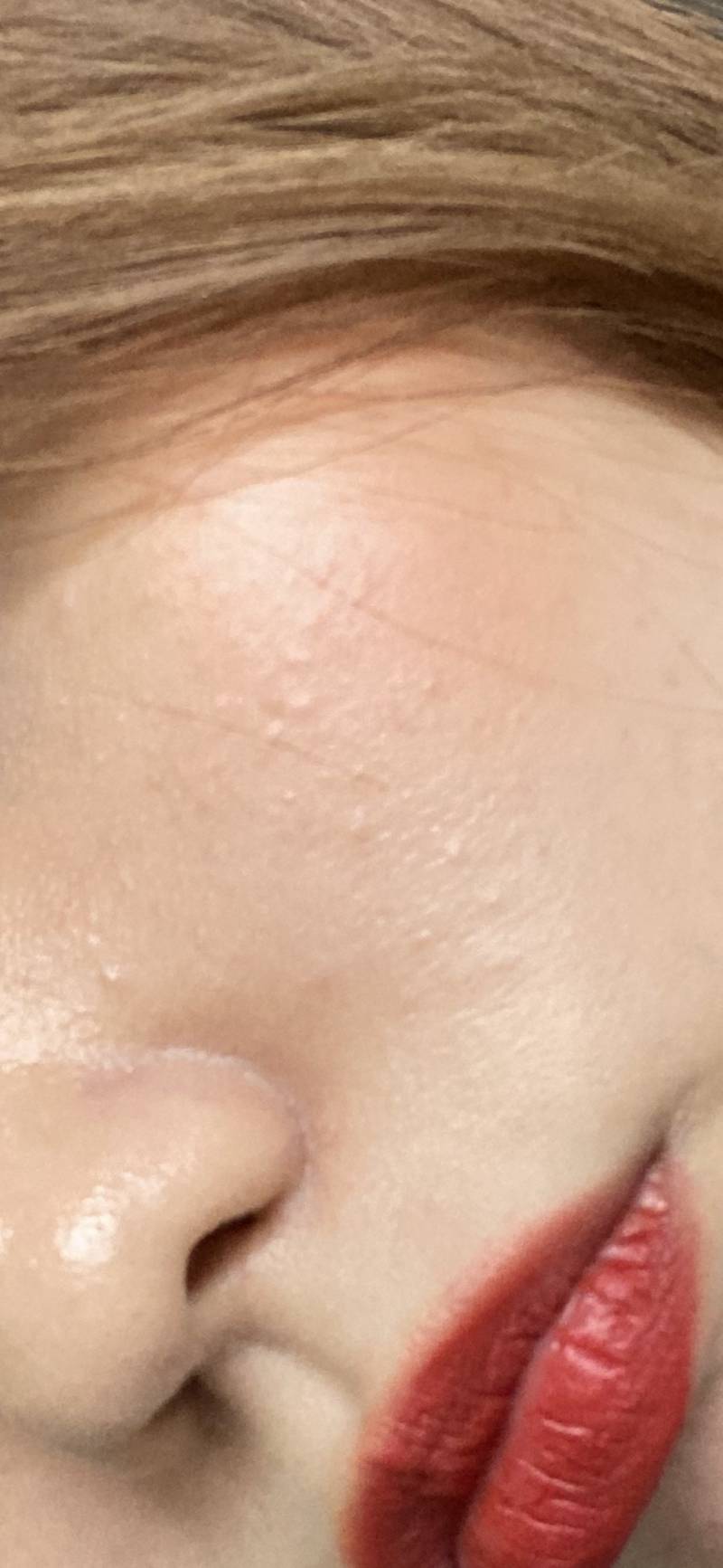 피부 이런 거 다 뭘까 ㅠㅠㅠ 40 | 인스티즈