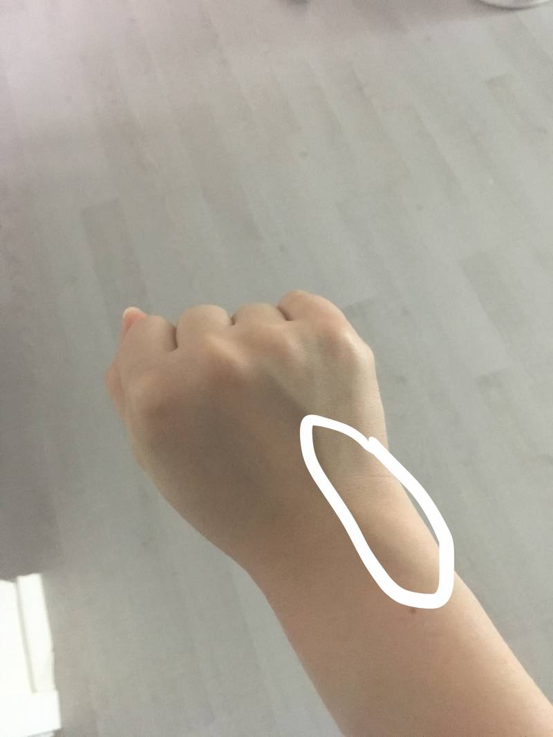 손목이 특정각도에서 엄청 아픈데 왜이럴까? | 인스티즈