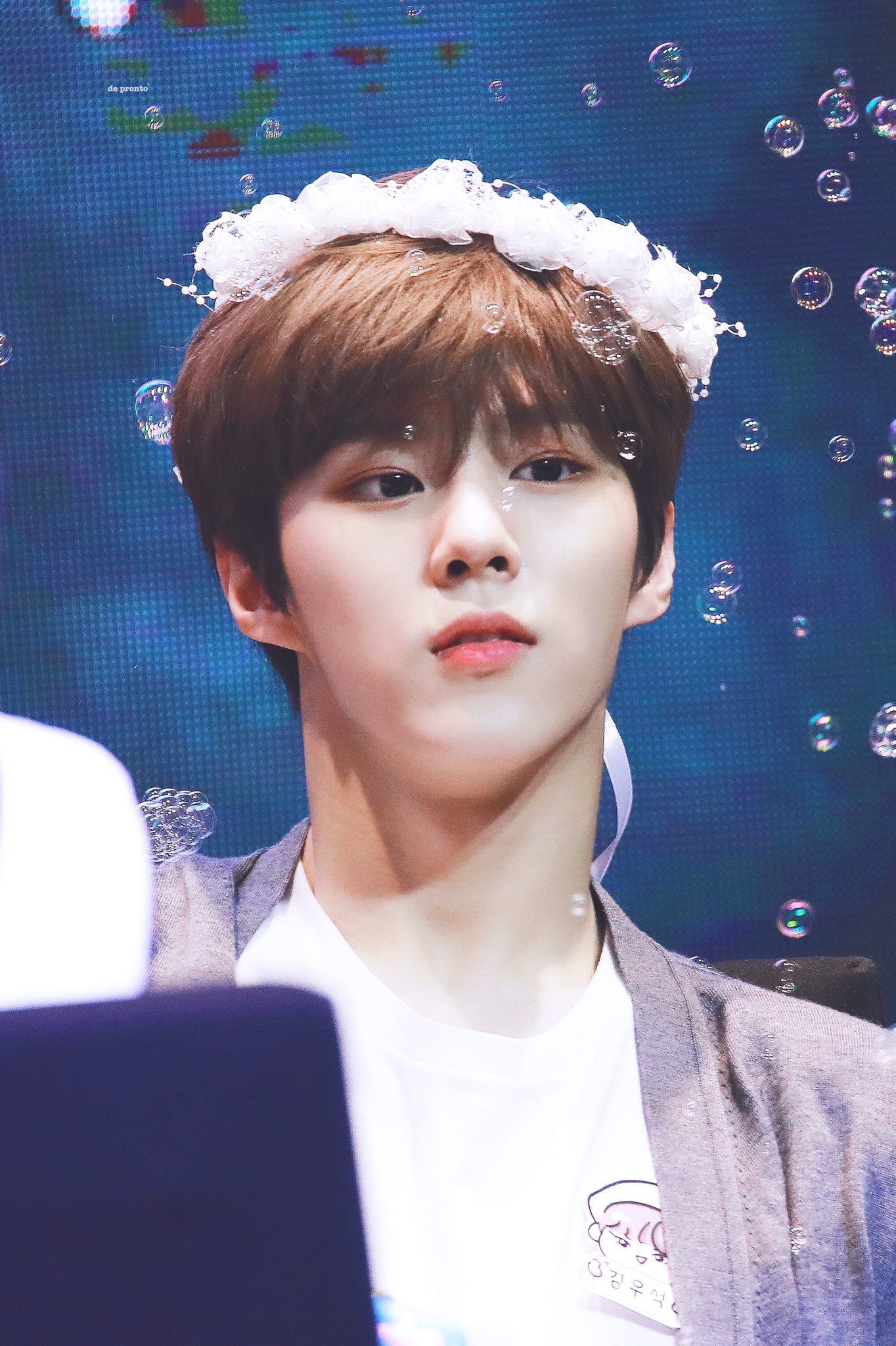 김우석 이 때 다래끼땜에 양쪽 다 퉁퉁부은거라는거 말도안됨 | 인스티즈