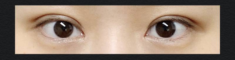 쌍수했는데 눈화장을 어떻게 해야 할까...? | 인스티즈