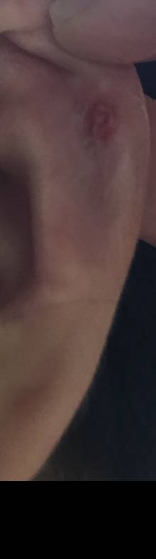 이거 살튀야? (ㅎㅇㅈㅇ)? | 인스티즈