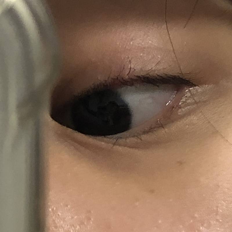 눈에뭐가 났어ㅜㅜㅜ 혐오주의 | 인스티즈