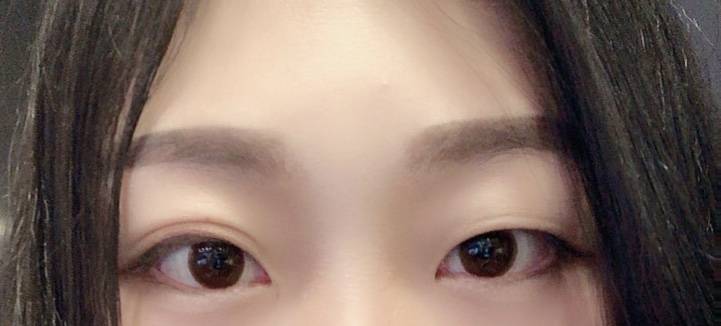 피곤하면 쌍커플 비슷하게 생기는데 | 인스티즈