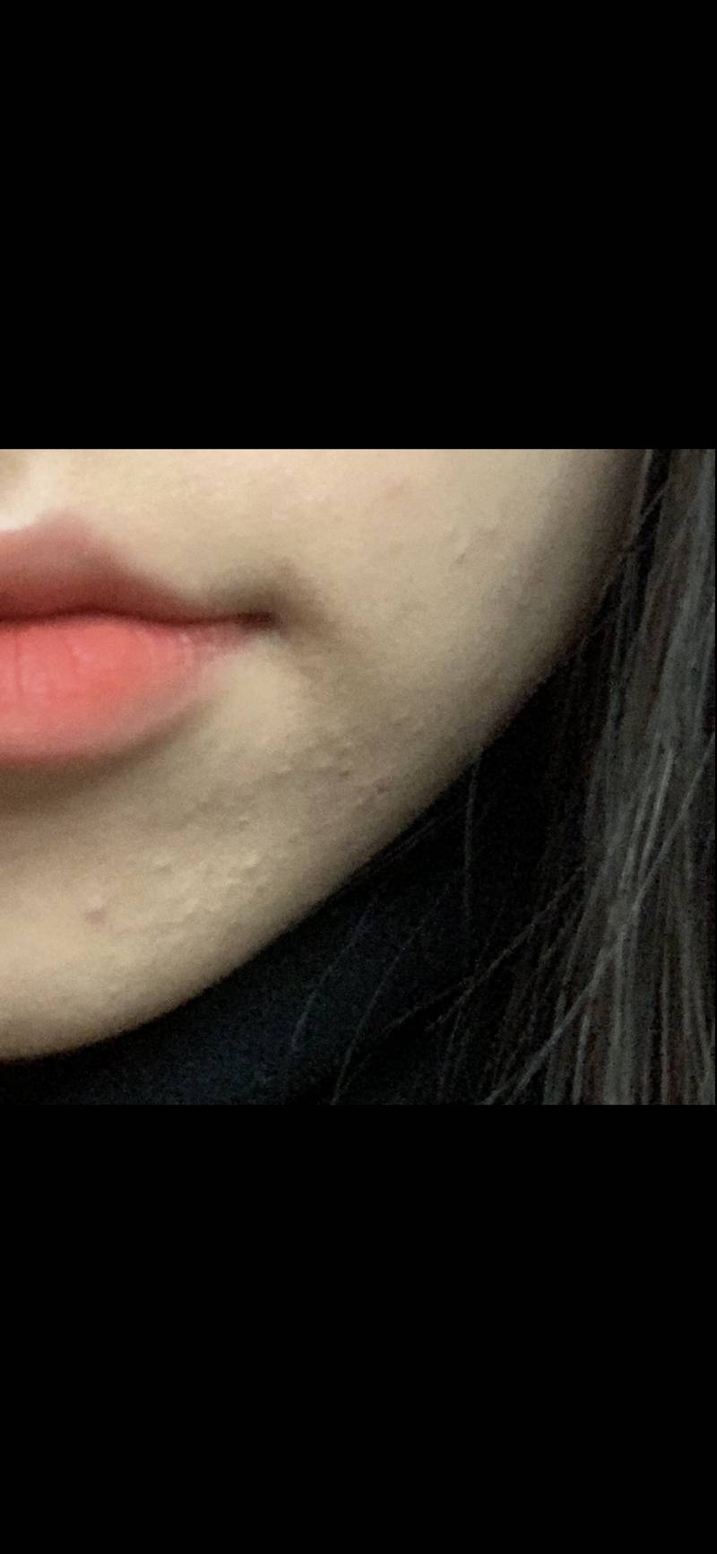 피부 오돌도돌한 거는 커버 어떻게 해야할까?(사진 유) | 인스티즈