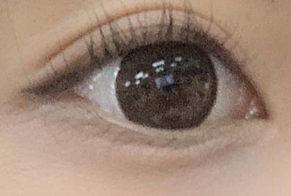 내 눈 앞트임 하면 안되지?40 | 인스티즈