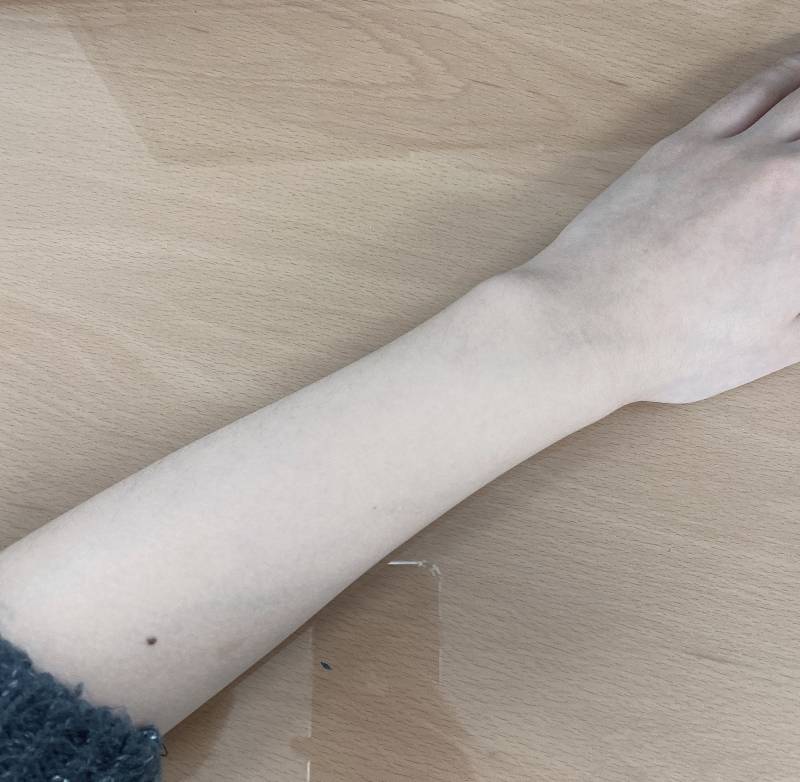 익인들 다들 팔에 이렇게 보이닝??나만 그랭?? | 인스티즈