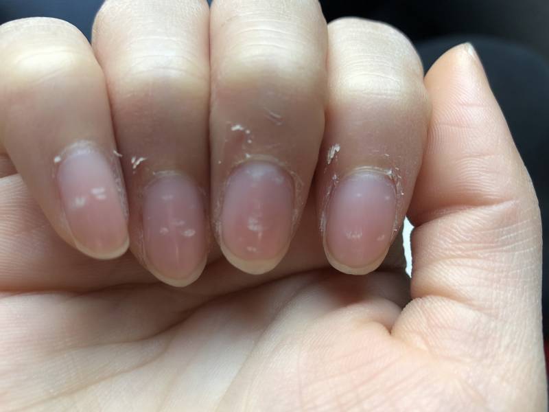 내 손 어떡해 ㅠㅠ | 인스티즈