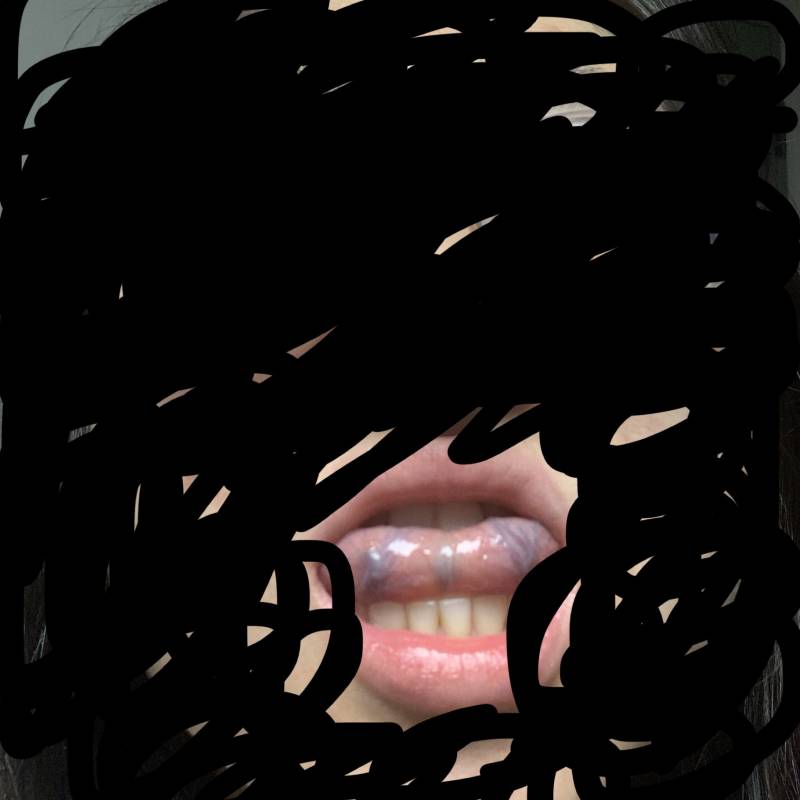 나 혹시 곧 죽어..??(ㅎㅇㅈㅇ) | 인스티즈