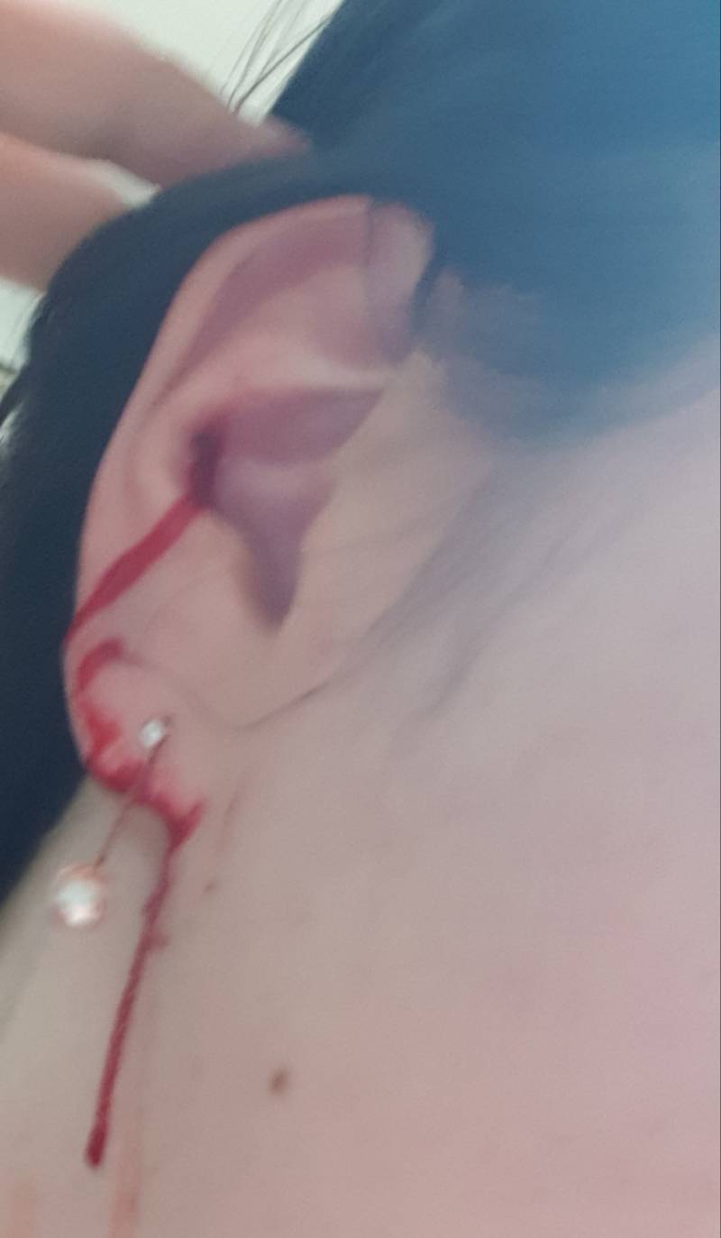 익들아 제발 봐줘 피어싱 뚫은지 한 시간 짼데 피나는 게 너무 심각해ㅠㅠㅠ | 인스티즈