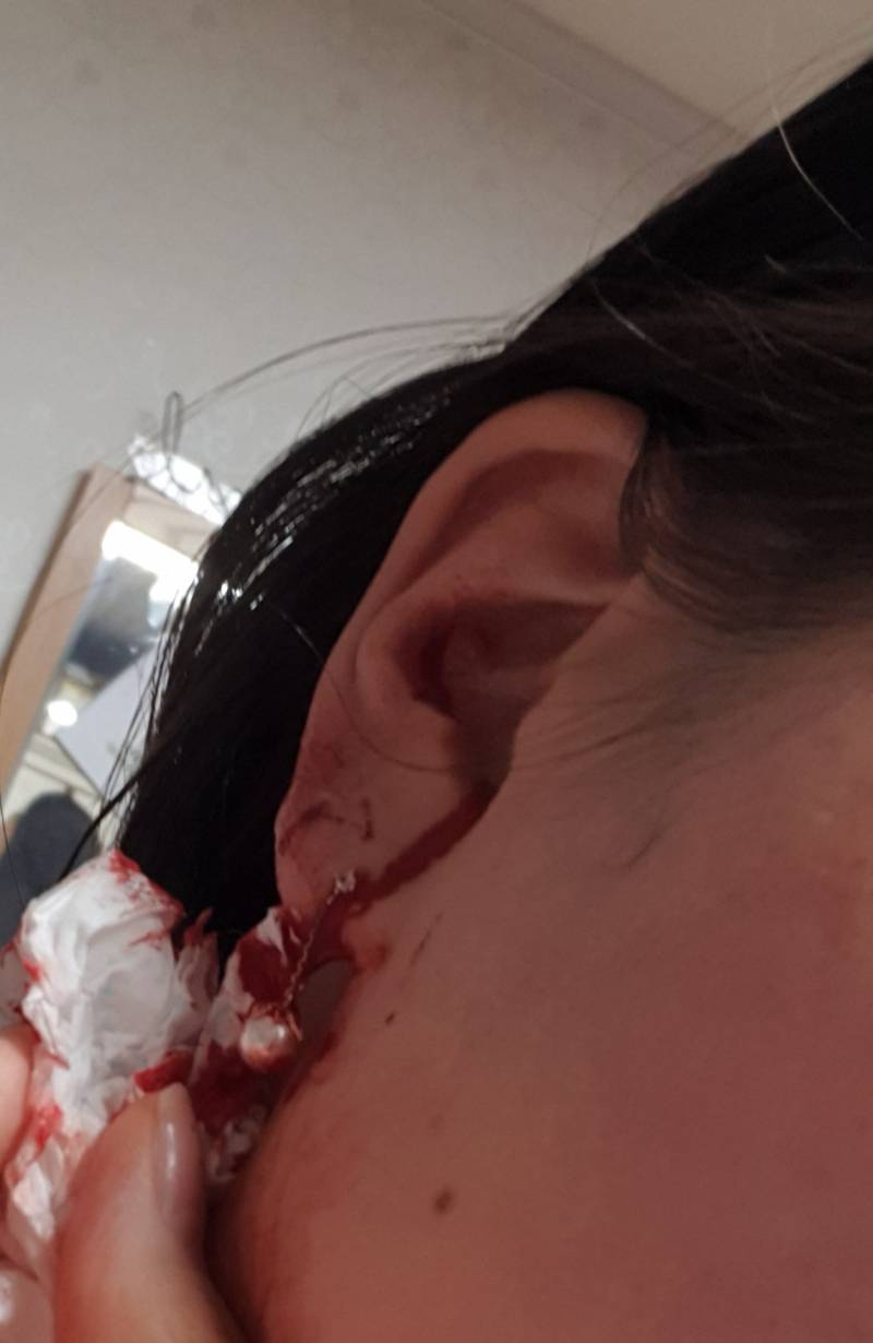 익들아 제발 봐줘 피어싱 뚫은지 한 시간 짼데 피나는 게 너무 심각해ㅠㅠㅠ | 인스티즈