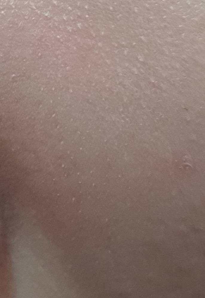 화장하고 이렇게 노랗게 올라온거 뭐야??(혐오주의) | 인스티즈