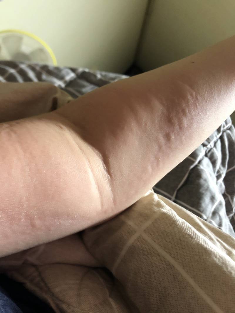 성인인데 갑자기 온 몸이 | 인스티즈