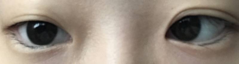 나 이거 쌍수 풀린거 맞지... | 인스티즈